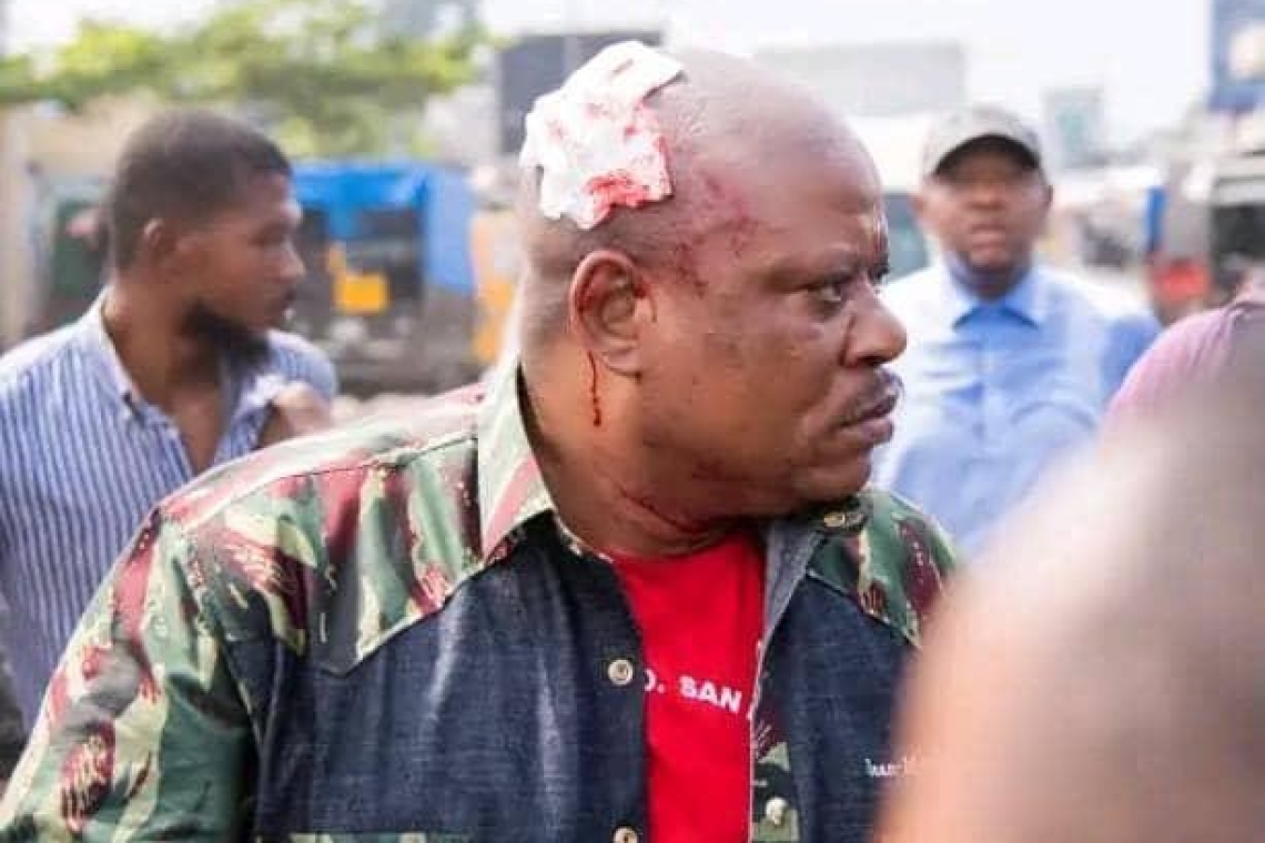 URGENT : l’Opposant Jean-Marc KABUND échappe à la mort au Camp Luka !